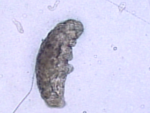 A water bear soil microbe x1000 magnification. Provided by Tom Loynachan water bear microbe