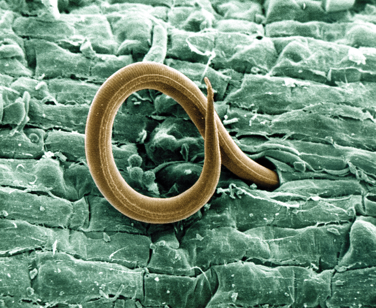 A juvenile root-knot nematode penetrates a tomato root. Once inside, the juvenile, which also attacks cotton roots, causes a gall to form and robs the plant of nutrients. Photo by William Wergin and Richard Sayre. Colorized by Stephen Ausmus. Source: USDA.