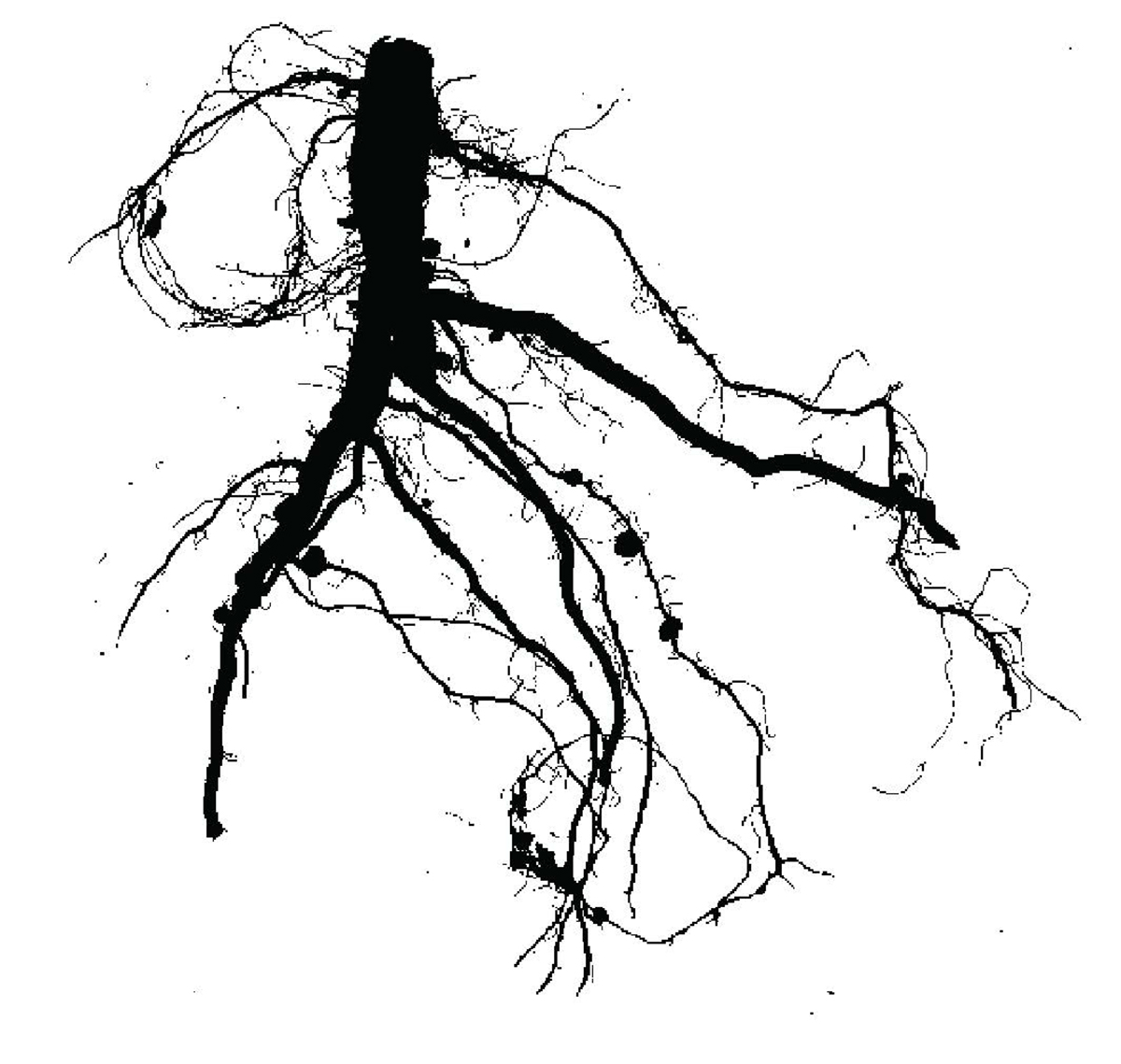 Two-dimensional (2D) imaging of soybean root system. Image courtesy of Sujata Bogati, first author on the study.